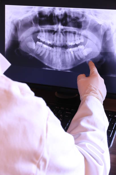 Best Weekend Emergency Dentist in South Hill, WA